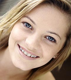 photo of a smiling teenage girl wearing braces